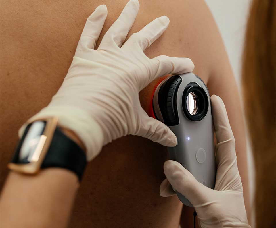 Dermatoscopio Illuco IDS 1100