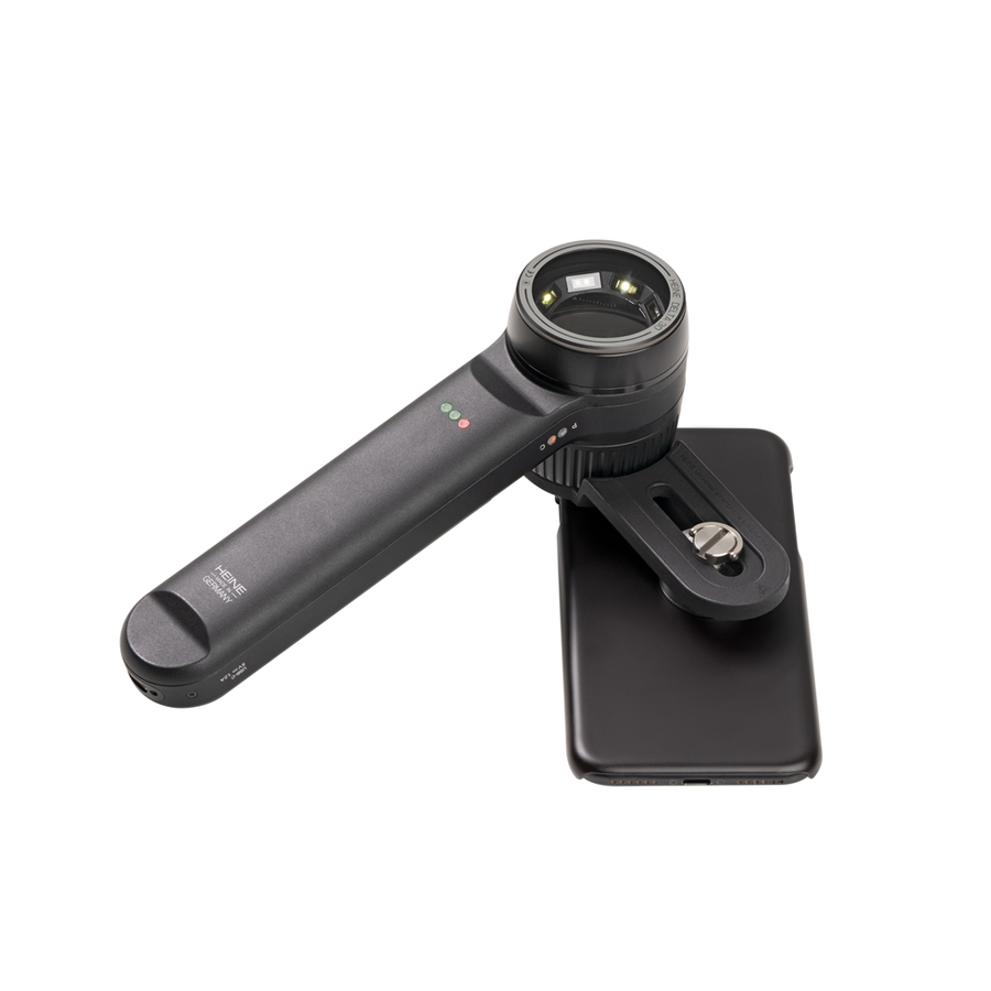 Adattatore Universale Smartphone/iPhone per Dermatoscopio Delta 30/Pro e DeltaONE