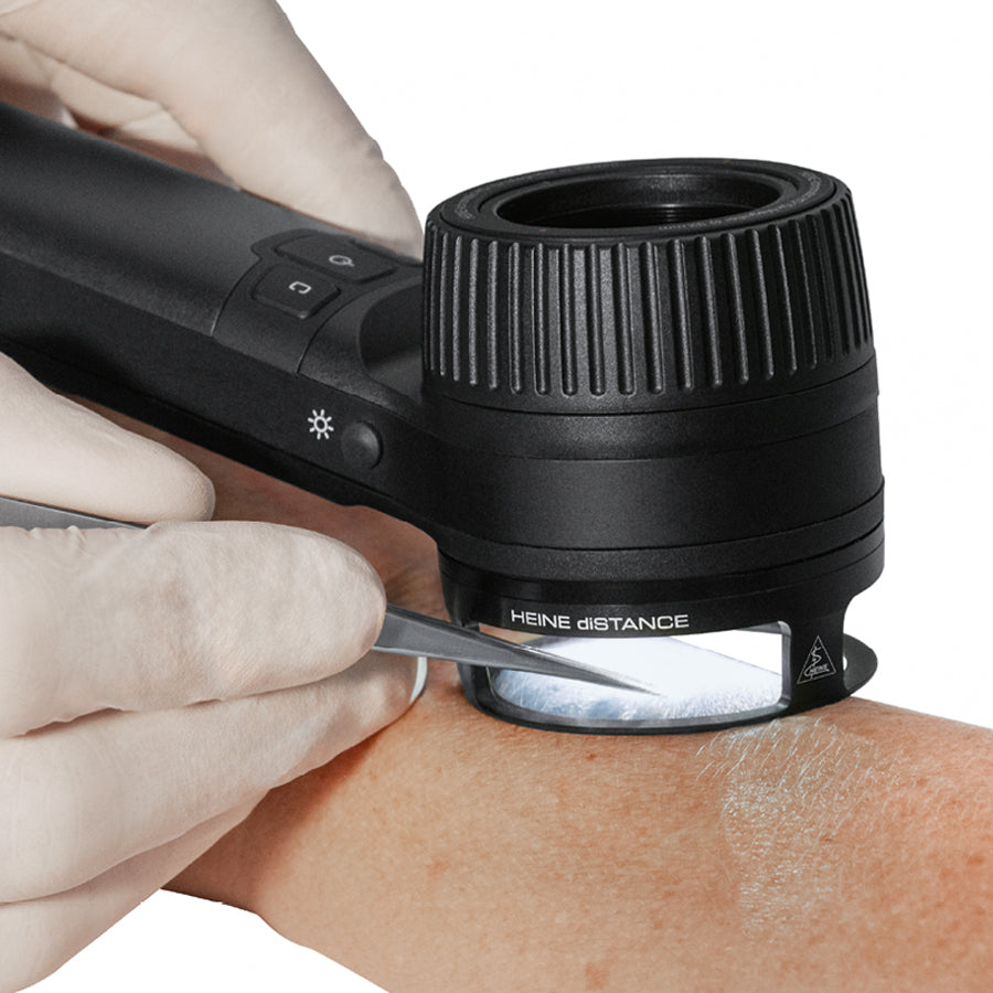 Anello distanziatore HEINE diSTANCE - Dermatoscopio Heine DELTA 30 e Delta 30 PRO