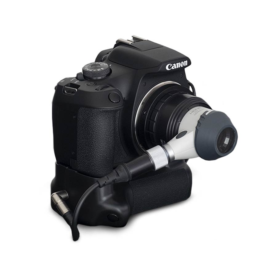 Videodermatoscopio DERMALview Laptop