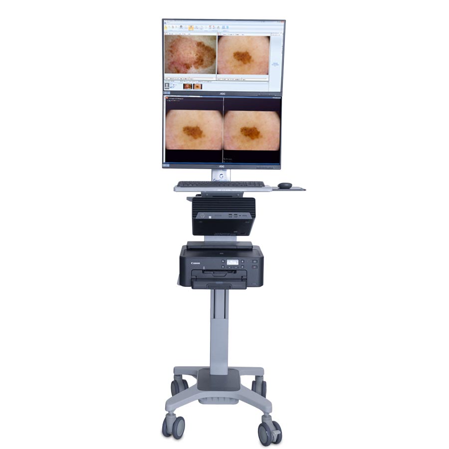 Videodermatoscopio DERMALview Vertical