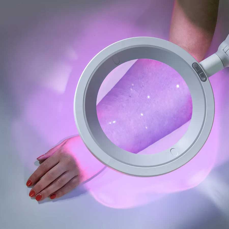 Lente d'ingrandimento OPTICLUX con luce LED/Wood - Soffitto o Stativo con ruote